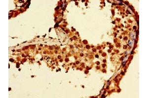 anti-Noncompact Myelin Associated Protein (NCMAP) (AA 54-102) antibody