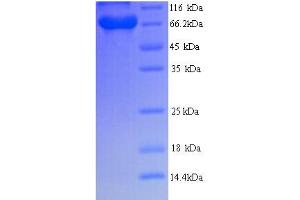 SDS-PAGE (SDS) image for BRCA1 Associated Protein (BRAP) (AA 1-592), (full length) protein (His tag) (ABIN5714412)