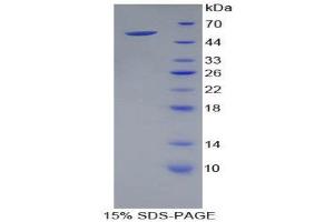SDS-PAGE (SDS) image for Kallikrein-Related Peptidase 4 (KLK4) (AA 32-255) protein (His tag,GST tag) (ABIN1878887) (Kallikrein 4 Protein (AA 32-255) (His tag,GST tag))