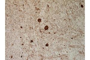 Immunostaining of PFA fixed, paraffin embedded section of a 5 x FAD mouse mouse brain. (NEFL anticorps  (AA 1-284))