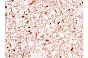 IHC image of ABIN7155098 diluted at 1:300 and staining in paraffin-embedded human brain tissue performed on a Leica BondTM system. (HNRNPA1 anticorps  (AA 2-354))