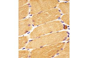 Antibody staining DVL1 in human skeletal muscle sections by Immunohistochemistry (IHC-P - paraformaldehyde-fixed, paraffin-embedded sections). (DVL1 anticorps  (AA 442-470))