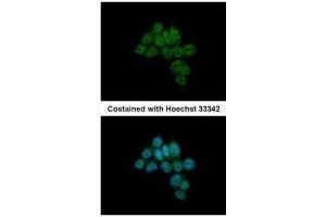 ICC/IF Image Immunofluorescence analysis of paraformaldehyde-fixed HCT116, using CREB3L1, antibody at 1:500 dilution. (CREB3L1 anticorps  (C-Term))