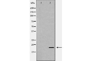 Western blot analysis of extracts of HEX-293, using MAX antibody. (MAX anticorps  (N-Term))