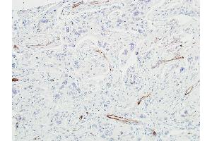 Immunohistochemistry (IHC) image for anti-Cadherin 5 (CDH5) (AA 48-599) antibody (ABIN7455190) (Recombinant Cadherin 5 anticorps  (AA 48-599))