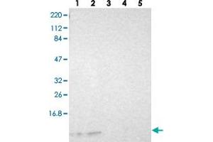 Western blot analysis of Lane 1: RT-4, Lane 2: U-251 MG, Lane 3: Human Plasma, Lane 4: Liver, Lane 5: Tonsil with RPS21 polyclonal antibody  at 1:250-1:500 dilution. (RPS21 anticorps)