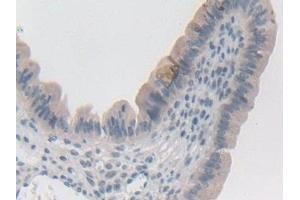 Detection of SYN1 in Mouse Uterus Tissue using Polyclonal Antibody to Synapsin I (SYN1)