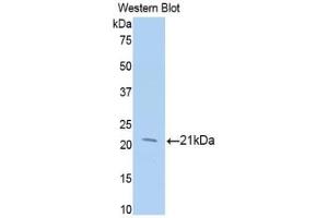 Western blot analysis of the recombinant protein. (MGEA5 anticorps  (AA 271-438))