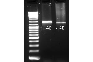 EndpointPCR with and without HotStart Antibody (Taq DNA Polymerase anticorps)