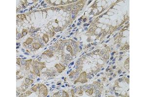 Immunohistochemistry of paraffin-embedded Human stomach using VIP Polyclonal Antibody