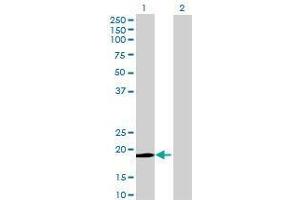 Lane 1: DBF4B transfected lysate ( 18. (DBF4B 293T Cell Transient Overexpression Lysate(Denatured))