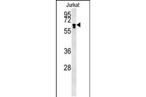 Western blot analysis in Jurkat cell line lysates (15ug/lane). (BTBD9 anticorps  (AA 237-262))
