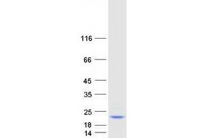 Validation with Western Blot