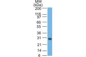 Western Blot Analysis of Jurkat cell lysate Bcl-x Mouse Monoclonal Antibody (2H12).