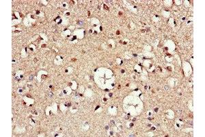 Immunohistochemistry of paraffin-embedded human brain tissue using ABIN7144390 at dilution of 1:100