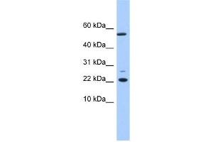 DPH4 antibody used at 1 ug/ml to detect target protein. (DNAJC24 anticorps  (N-Term))