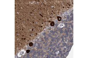 Immunohistochemical staining of human cerebellum with KCTD8 polyclonal antibody  shows strong cytoplasmic positivity in Purkinje cells at 1:20-1:50 dilution. (KCTD8 anticorps)