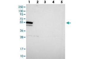 Western blot analysis of Lane 1: RT-4, Lane 2: U-251 MG, Lane 3: Human Plasma, Lane 4: Liver, Lane 5: Tonsil with DHX34 polyclonal antibody . (DHX34 anticorps)