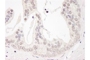 Immunohistochemistry (IHC) image for anti-Cyclin L1 (CCNL1) (AA 300-350) antibody (ABIN7454803)