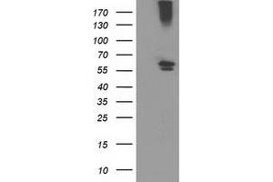 Western Blotting (WB) image for anti-Cytochrome P450, Family 2, Subfamily J, Polypeptide 2 (CYP2J2) antibody (ABIN1497731)