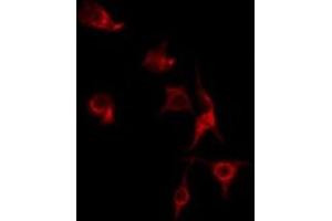 ABIN6275608 staining HT29 by IF/ICC. (SFRS7 anticorps  (Internal Region))