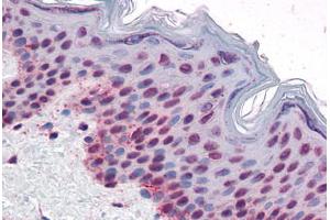 anti-Aurora Kinase B (AURKB) (pThr232) antibody