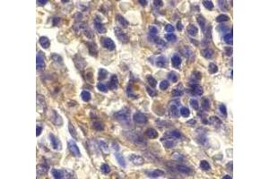 Immunohistochemistry of Bonzo in human spleen cells with Bonzo antibody at 20 μg/ml.