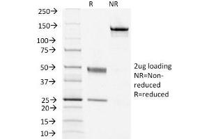 SDS-PAGE Analysis Purified TSHRB Monoclonal Antibody (TSHRB/1405). (TSH receptor anticorps)