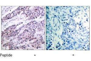 Image no. 1 for anti-B-Cell CLL/lymphoma 2 (BCL2) (AA 54-58) antibody (ABIN197202) (Bcl-2 anticorps  (AA 54-58))