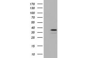 Western Blotting (WB) image for anti-E3 SUMO-Protein Ligase NSE2 (NSMCE2) antibody (ABIN1499526) (NSMCE2 anticorps)