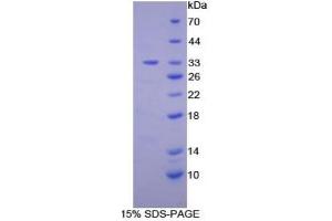 SDS-PAGE of Protein Standard from the Kit (Highly purified E.