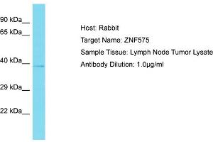Host: Rabbit Target Name: ZNF575 Sample Tissue: Human Lymph Node Tumor Antibody Dilution: 1ug/ml (ZNF575 anticorps  (Middle Region))