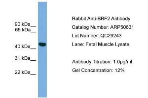 WB Suggested Anti-BRF2  Antibody Titration: 0. (BRF2 anticorps  (Middle Region))