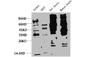 Western blot analysis of 1) Jurkat, 2) 293T, 3) Rat Brain Tissue, 4) Mouse Brain Tissue with Phosphotyrosine Mouse mAb diluted at 1:2,000. (Phosphotyrosine anticorps)
