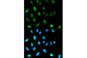 Immunofluorescence analysis of HeLa cells using CBX5 antibody. (CBX5 anticorps)
