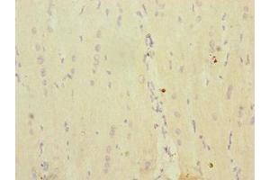 Immunohistochemistry of paraffin-embedded human heart tissue using ABIN7142250 at dilution of 1:100