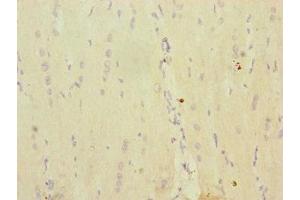 Immunohistochemistry of paraffin-embedded human heart tissue using ABIN7142250 at dilution of 1:100 (MRPS16 anticorps  (AA 1-137))