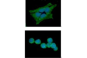 ICC/IF analysis of GSS in HeLa cells line, stained with DAPI (Blue) for nucleus staining and monoclonal anti-human GSS antibody (1:100) with goat anti-mouse IgG-Alexa fluor 488 conjugate (Green).