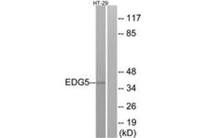 Western blot analysis of extracts from HT-29 cells, using EDG5 Antibody. (S1PR2 anticorps  (AA 261-310))