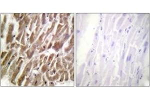 Immunohistochemistry (IHC) image for anti-Cardiac Troponin I (TNNI3) (AA 11-60) antibody (ABIN2888778) (TNNI3 anticorps  (AA 11-60))