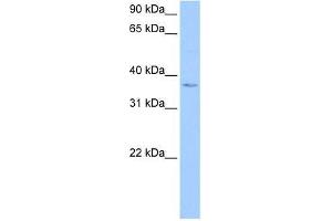 Western Blot showing hCG_1982709 antibody used at a concentration of 1-2 ug/ml to detect its target protein. (hCG_1982709 (N-Term) anticorps)