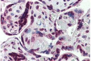 Human Placenta: Formalin-Fixed, Paraffin-Embedded (FFPE) (SHROOM2 anticorps  (AA 1554-1616))