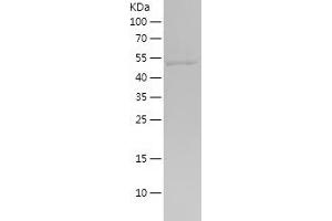 Western Blotting (WB) image for Glutathione Reductase (GSR) (AA 273-522) protein (His-IF2DI Tag) (ABIN7123134)