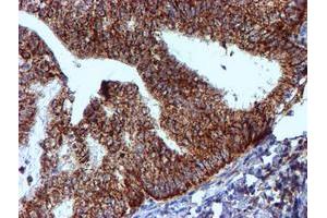 Image no. 9 for anti-NADH Dehydrogenase (Ubiquinone) 1 beta Subcomplex, 9, 22kDa (NDUFB9) (AA 3-179) antibody (ABIN1491359)