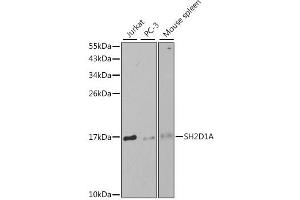 Western blot analysis of extracts of various cell lines, using SH2D1A antibody. (SH2D1A anticorps)