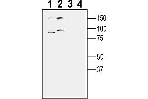 Western blot analysis of human Malme-3M melanoma cell line lysate (lanes 1 and 3) and human PANC1 pancreatic duct carcinoma cell line lysate (lanes 2 and 4):1-2. (TYRO3 anticorps  (Extracellular))