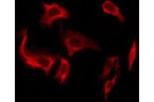 ABIN6276238 staining A549 by IF/ICC.