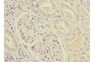 Immunohistochemistry of paraffin-embedded human kidney tissue using ABIN7160958 at dilution of 1:100 (NDUFS3 anticorps  (AA 37-264))