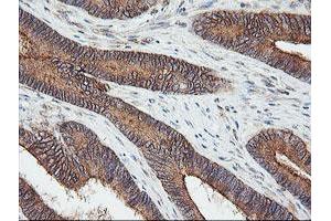 Image no. 1 for anti-Ubiquitin-Conjugating Enzyme E2G 2 (UBE2G2) antibody (ABIN1501630)