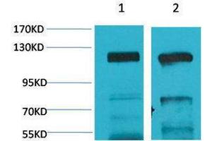 Western Blotting (WB) image for anti-Glutamate Receptor, Ionotropic, AMPA 4 (GRIA4) antibody (ABIN3179048) (GRIA4 anticorps)